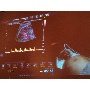 MSZNUT 2011. Pécs - Live Scanning 30.